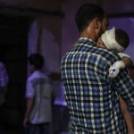 Un bambino ferito dai bombardamenti è in ospedale in braccio allo zio Un bambino ferito dai bombardamenti è in ospedale in braccio allo zio