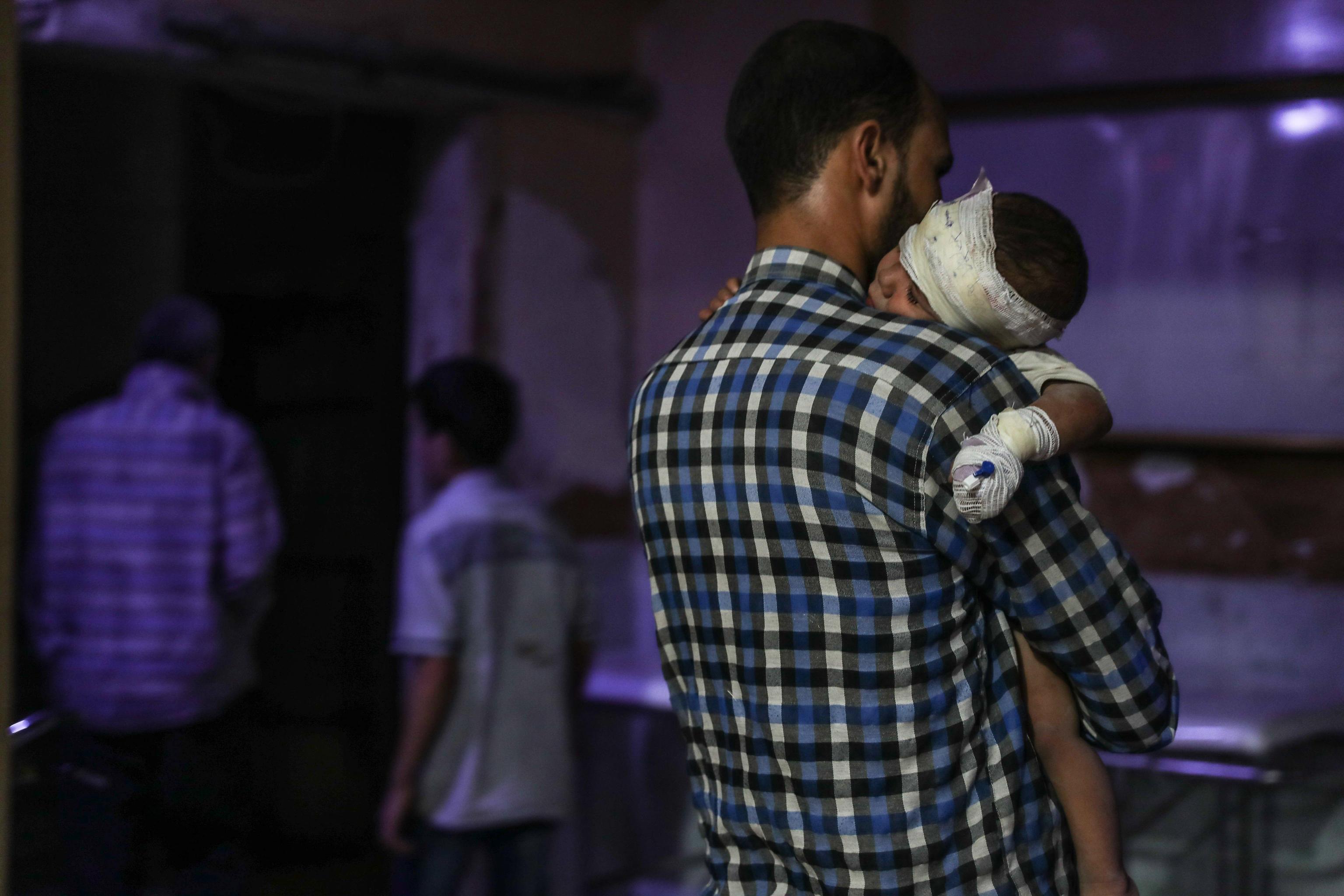 Un bambino ferito dai bombardamenti è in ospedale in braccio allo zio Un bambino ferito dai bombardamenti è in ospedale in braccio allo zio