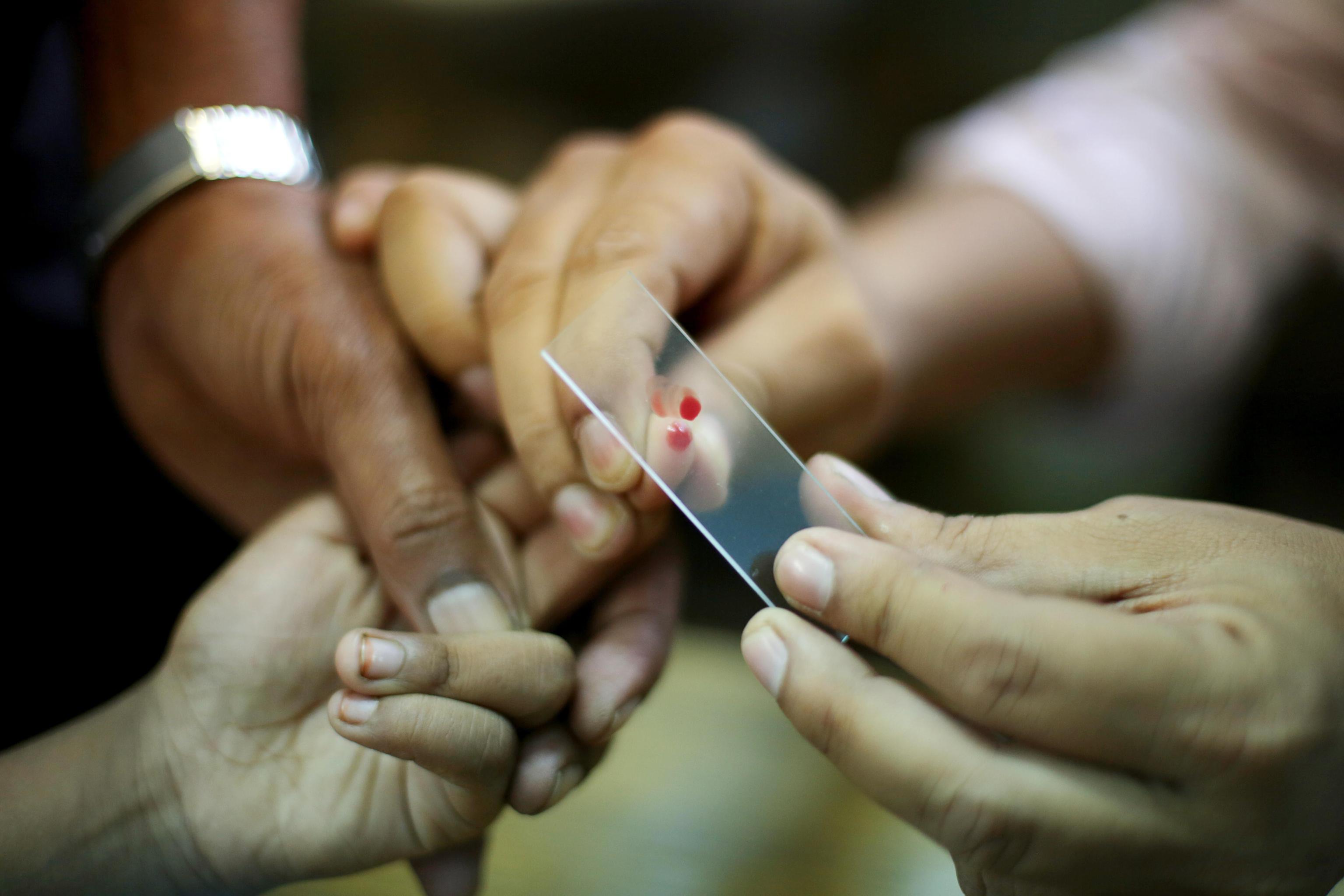 Campioni di sangue raccolti da un medico in una clinica di Calcutta