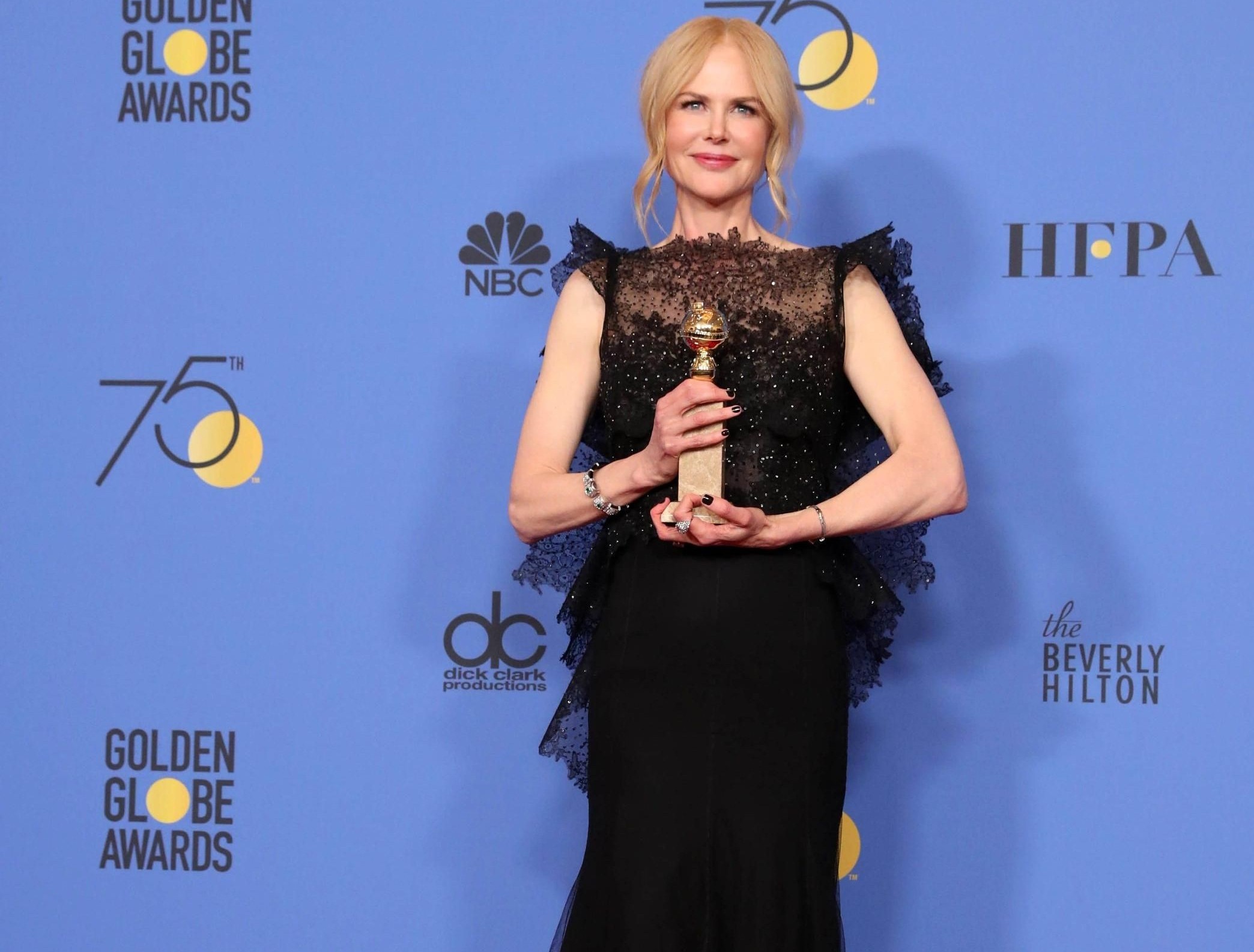 Nicole Kidman, premiata come migliore attrice per "Big Little Lies"