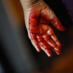 La mano insanguinata di un ragazzo dopo la flagellazione autoinflitta
