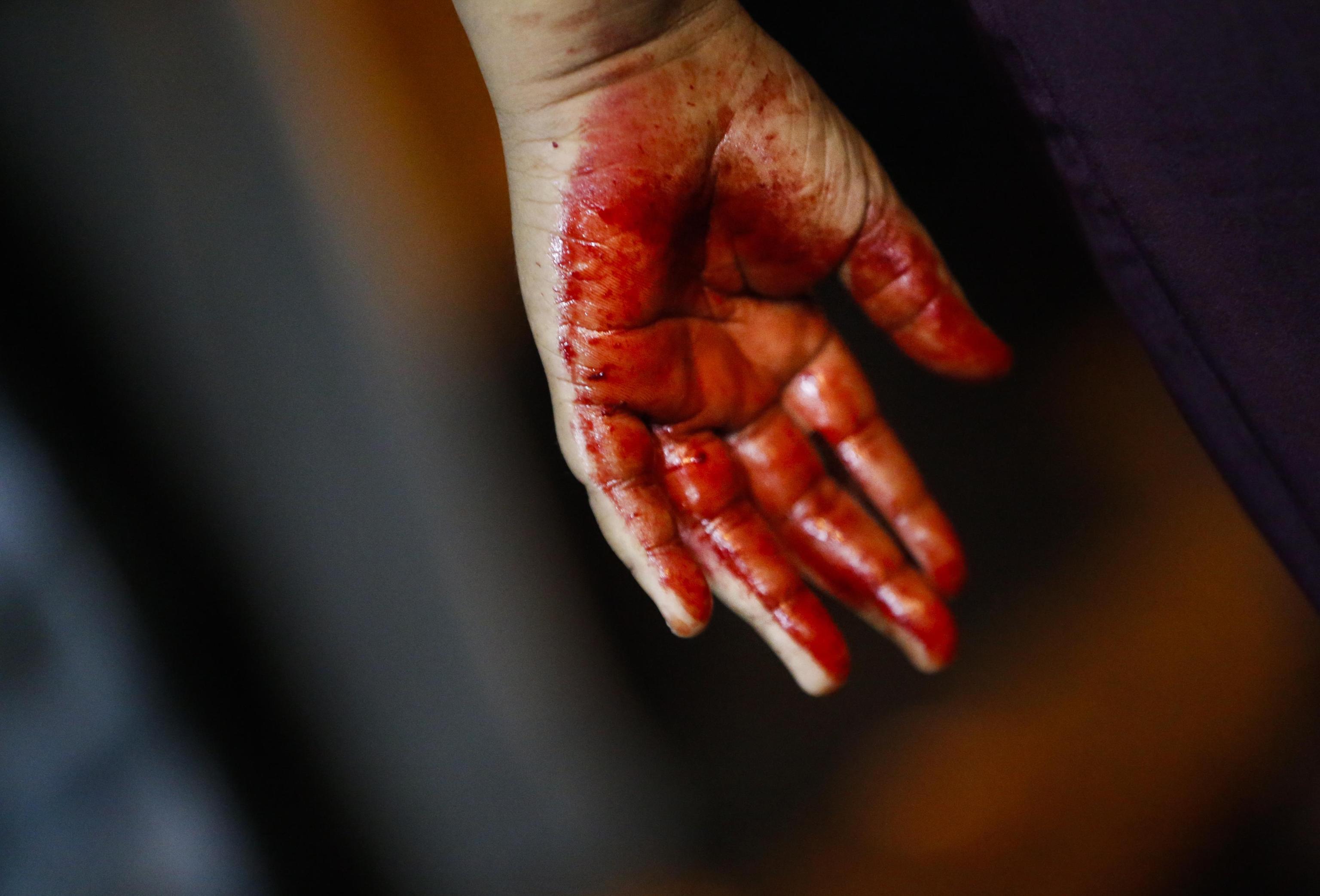 La mano insanguinata di un ragazzo dopo la flagellazione autoinflitta La mano insanguinata di un ragazzo dopo la flagellazione autoinflitta