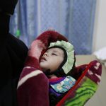 Bambino, affetto da colera, in attesa di cure.