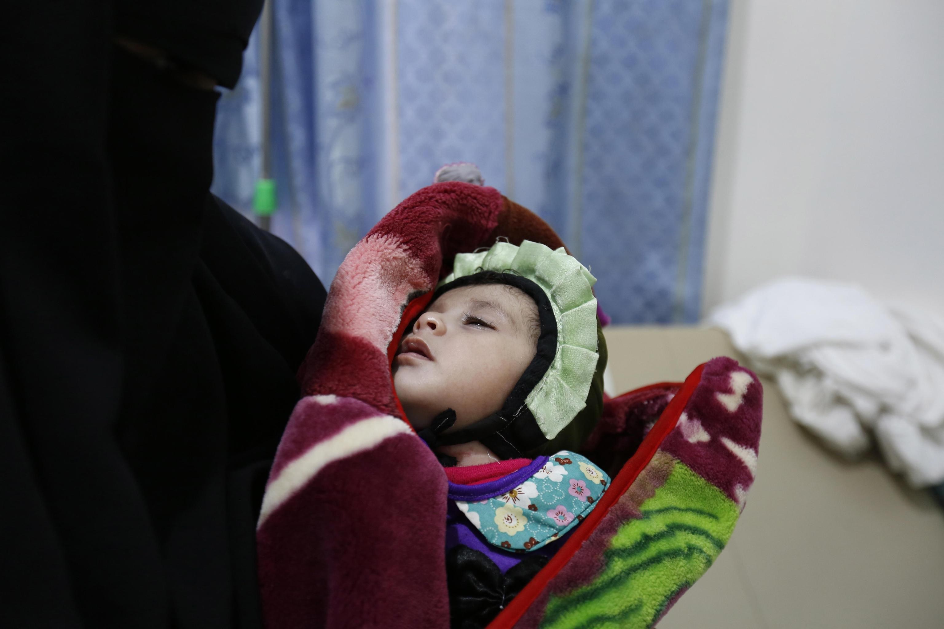 Bambino, affetto da colera, in attesa di cure.