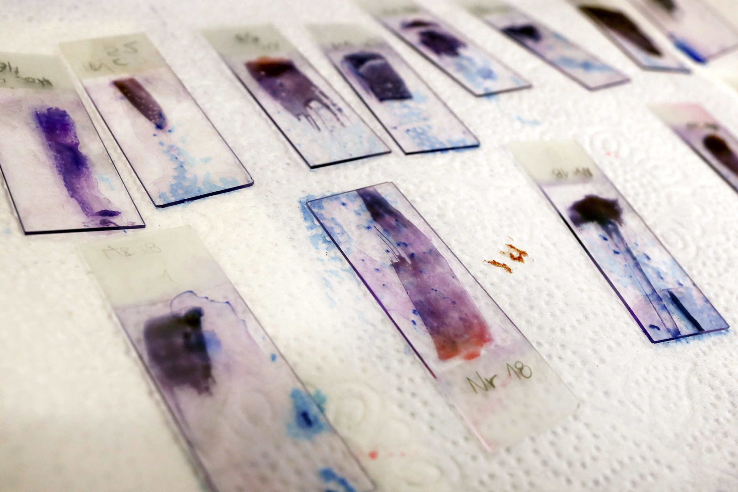 Campioni di sangue di diversi pesci analizzati in laboratorio